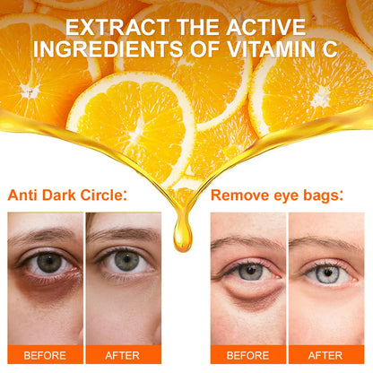 Anti Dark Circle Eye Cream Eye Bags